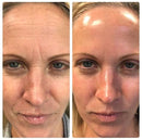 Massageador Facial com Fototerapia Anti-Rugas - GlowUp